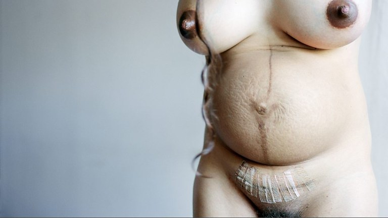 Foto eines nackten weiblichen Körpers. Postpartum.